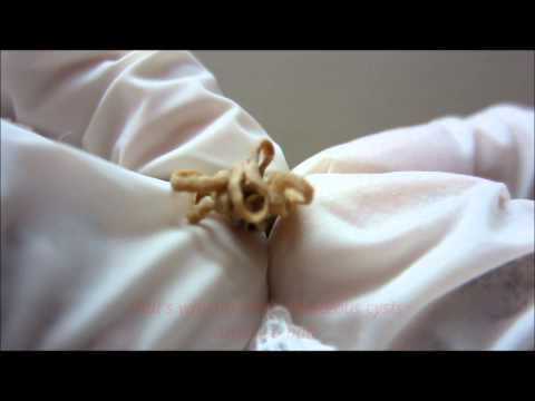 how to unclog eyelid oil glands