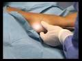 Medilaser Clinica
