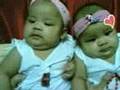 twins photoalbum