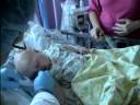 Dr. Staffenberg Removing Bandages