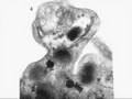 Medical School Pathology, Chapter 4e