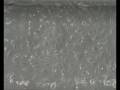 eosinophil adhesion to primary HUVECS1