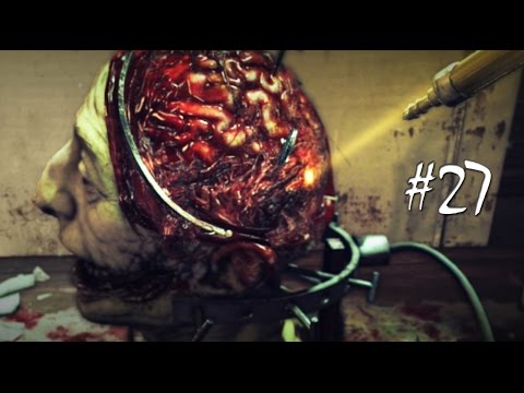 how to perform brain surgery at home