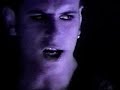social distortion on xray