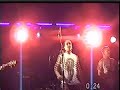 DISPLASIA- HASTA LA VICTORIA SIEMPRE