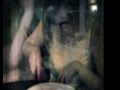 Lost in a Diagnosis: EDNOS