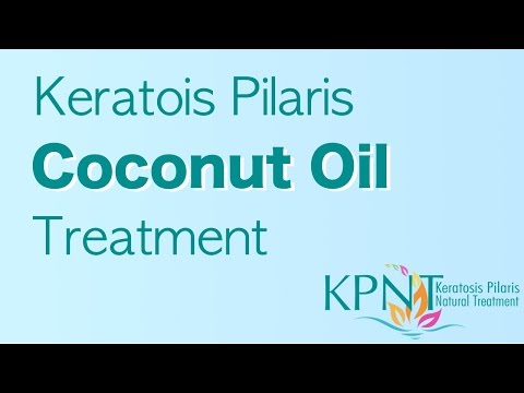 how to treat kp with coconut oil