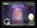 videos de Second Opinion 1.5 XS Guide