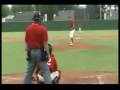 kid hit in head with baseball