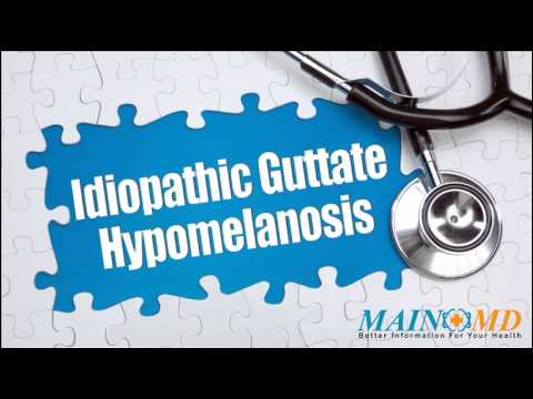 how to cure idiopathic guttate hypomelanosis