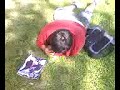 broken leg/fibula video 3