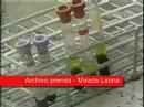 promoción de la prueba del vih en los medios
