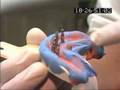 Lasik in Istanbul mit Beauty Travels Istanbul (4 von 5)