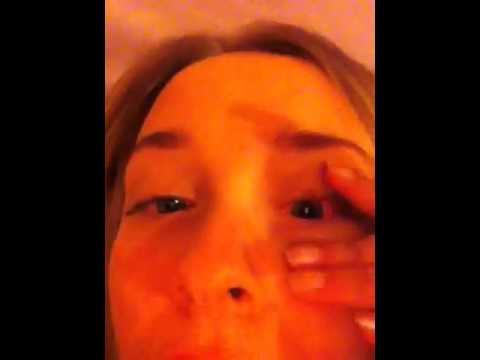 how to get rid conjunctivitis