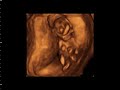 echographie 12SA