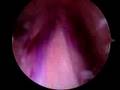 Dr. James Bond: acl... View Video