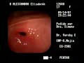 Endoscopia Digestiva Lizy Endoscopia Digestiva Lizy
