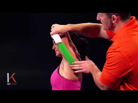 how to relieve tricep pain