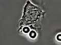 Citologia Leucocitos fagocitando Candida albicans Citologia Leucocitos fagocitando Candida albicans