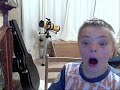 downs syndrome downs syndrome