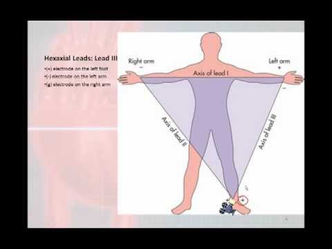 how to apply ecg leads