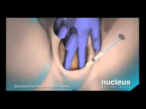 Childbirth