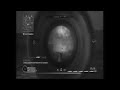 PUR3 R3ACTIONZ - COD 4 NO-SCOPE MONTAGE HIGH QUALITY