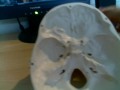 A rapid review of the internal structures of the cranium and the exit points of the 12 cranial nerves.