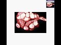 Thumbnail #1
