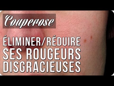 De fortes époques sur la personne de la photo