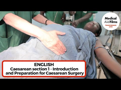 how to perform an emergency c section