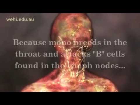 how to relieve mono symptoms