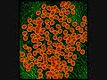 Dexter - Infect Dexter - Infect