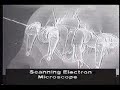 Informative video about Dust Mites Informative video about Dust Mites