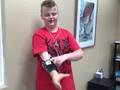 Kellen's Myoelectric Prosthesis