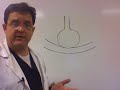 BIPAP Part-1 BIPAP Part-1