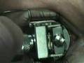 Chirurgie des yeux au laser