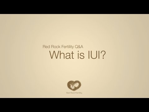 how to perform iui