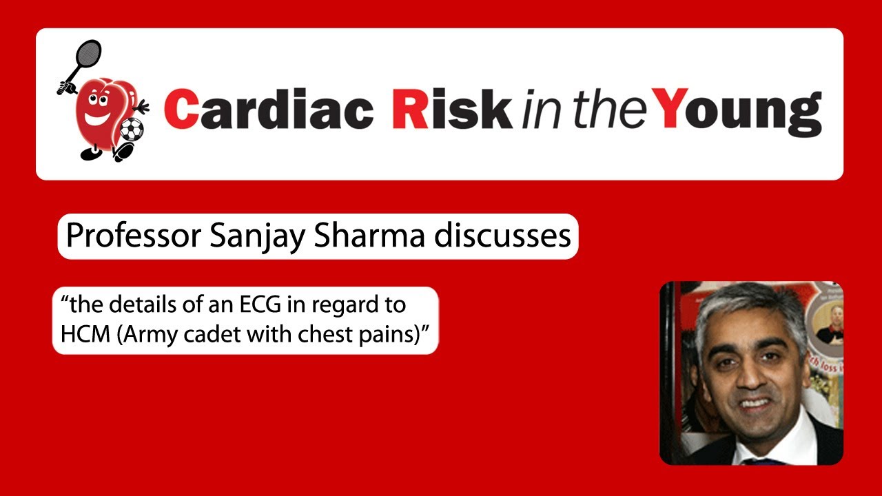 ECG 5: HCM (Army cadet with chest pains)