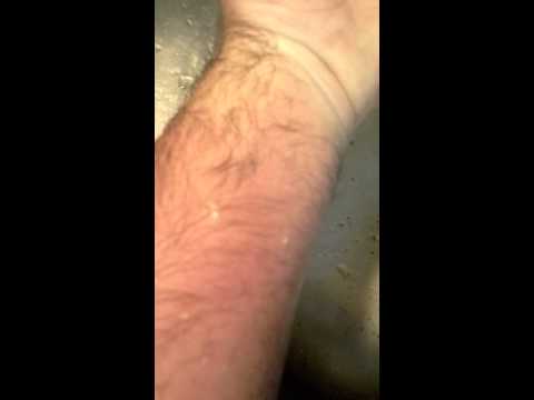 how to treat a sting from a wasp