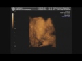 Little Baby Gray: 29 Weeks Part 2