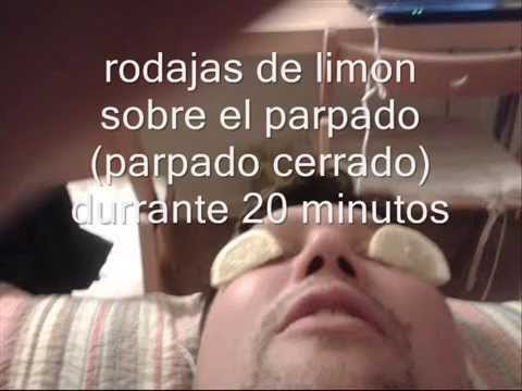 how to cure watery eyes