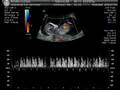 Bebe 13 semanas
