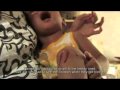 Drop of Hemophilia Love - Tetes Cinta Hemofilia - Part 1