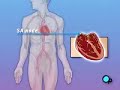 PreOp® Patient Education Permanent Pacemaker Implant Surgery
