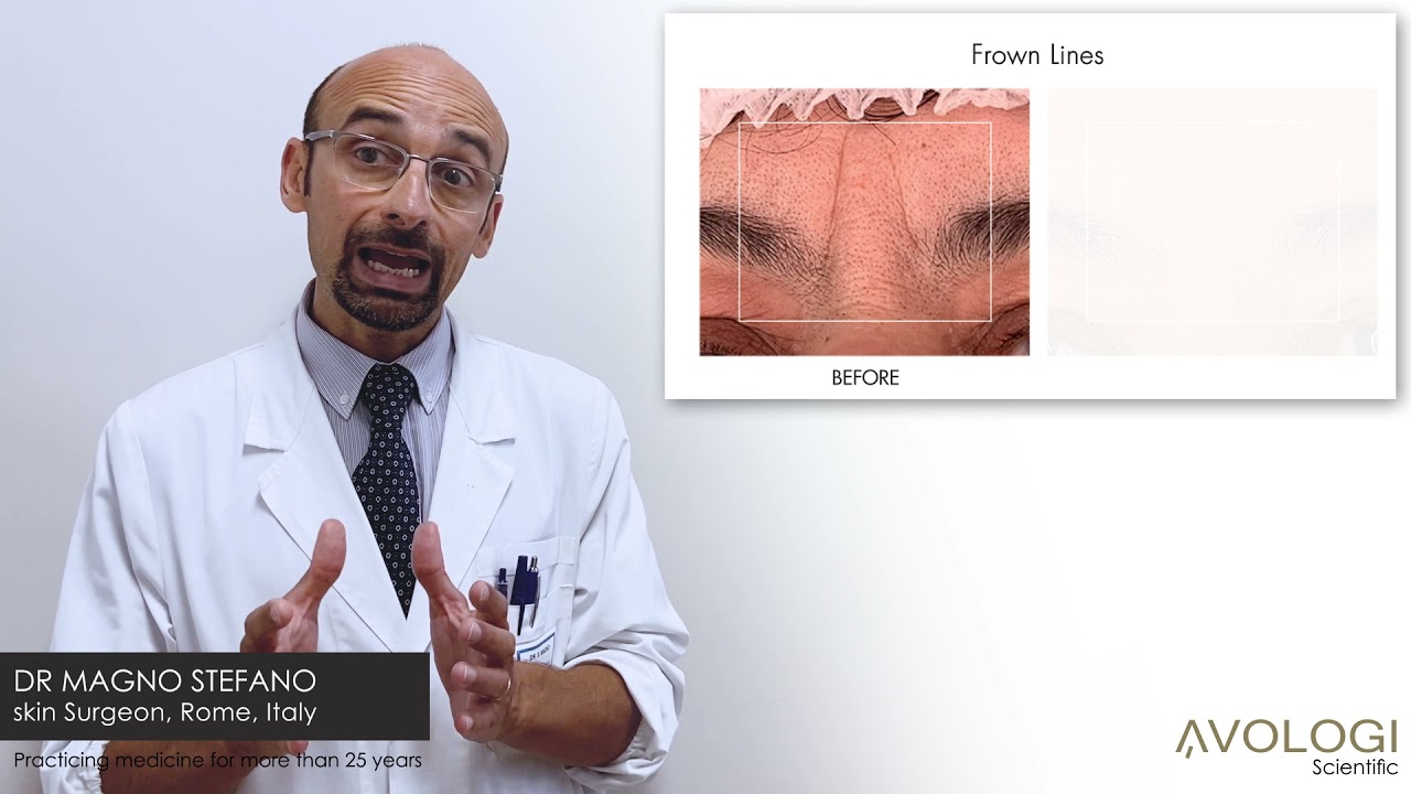 Avologi Eneo Totale review by Doctor Stefano Magno