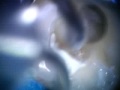Thumbnail #1