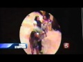 RICK ROSS GOT JACKED WTF??? SUM SNEAKY ASS HOES ROBBED RICK ROSS AT HOTEL