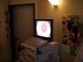 My first date with an endoscope