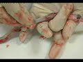 Cryo save - Postupak uzimanja maticnih celija Cryo save - Postupak uzimanja maticnih celija